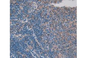 Used in DAB staining on fromalin fixed paraffin- embedded spleen tissue (CFP Antikörper  (AA 65-190))