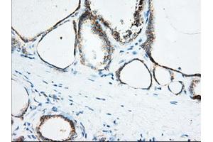 Immunohistochemical staining of paraffin-embedded Human Kidney tissue using anti-KHK mouse monoclonal antibody. (Ketohexokinase Antikörper)