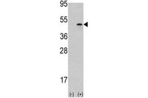 Western blot analysis of Aurora B antibody and 293 cell lysate (2 ug/lane) either nontransfected (Lane 1) or transiently transfected with the AURKB gene (2). (Aurora Kinase B Antikörper  (AA 283-313))
