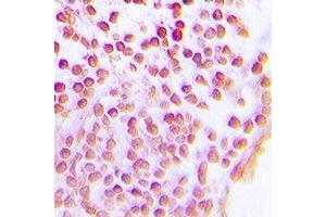 Immunohistochemistry (IHC) image for anti-Sirtuin 1 (SIRT1) antibody (ABIN7308334) (SIRT1 Antikörper)