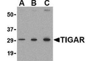 Western blot analysis of TIGAR in MCF7 cell lysate with this product at (A) 0. (TIGAR Antikörper  (Center))