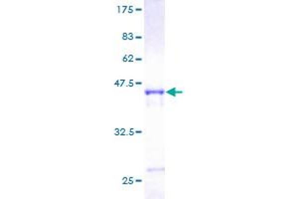 ARL3 Protein (AA 1-182) (GST tag)