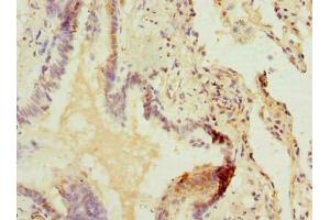 Immunohistochemistry of paraffin-embedded human lung tissue using ABIN7162554 at dilution of 1:100 (ZDHHC5 Antikörper  (AA 231-500))
