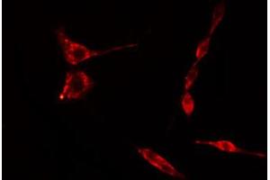 ABIN6274749 staining Hela cells by IF/ICC. (RPS15 Antikörper  (C-Term))
