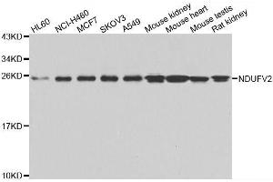 Western blot analysis of extracts of various cell lines, using NDUFV2 antibody. (NDUFV2 Antikörper  (AA 1-249))