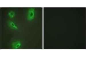 Immunofluorescence analysis of HeLa cells, using BCKD Antibody . (BCKDK Antikörper  (AA 11-60))