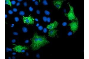 Anti-KATNB1 mouse monoclonal antibody (ABIN2455185) immunofluorescent staining of COS7 cells transiently transfected by pCMV6-ENTRY KATNB1 (RC201852). (KATNB1 Antikörper)