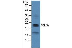 Western blot analysis of Rat Heart Tissue. (Dual Specificity Phosphatase 3 (DUSP3) (AA 2-185) Antikörper)