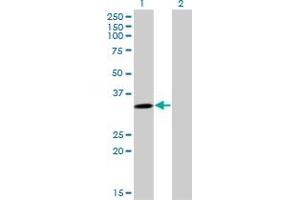 Western Blot analysis of SULT4A1 expression in transfected 293T cell line by SULT4A1 monoclonal antibody (M02), clone 3C1. (SULT4A1 Antikörper  (AA 1-100))