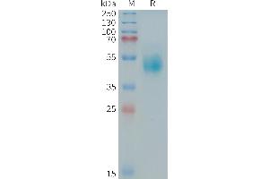 SDS-PAGE (SDS) image for Receptor Tyrosine-Protein Kinase ErbB-3 (ERBB3) (AA 544-643) protein (Fc Tag) (ABIN7538507)