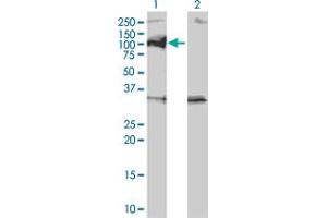 Western Blotting (WB) image for anti-Protein Phosphatase, Mg2+/Mn2+ Dependent, 1D (PPM1D) (AA 496-605) antibody (ABIN563650)