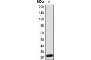 Western blot analysis of IL-18 expression in Hela (A) whole cell lysates. (IL-18 Antikörper)
