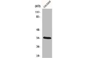 Western Blot analysis of COLO205 cells using MOX-2 Polyclonal Antibody (MEOX2 Antikörper  (Internal Region))
