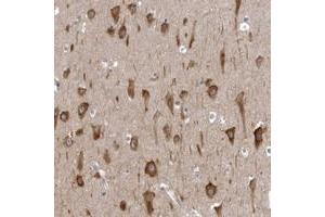 Immunohistochemical staining of human hippocampus with AADACL1 polyclonal antibody  shows strong cytoplasmic positivity in neuronal cells. (NCEH1 Antikörper)