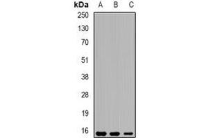 Western blot analysis of Eppin expression in THP1 (A), mouse liver (B), mouse testis (C) whole cell lysates.