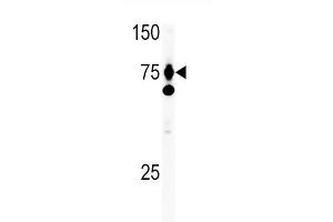 The anti-HGF Pab (ABIN388462 and ABIN2848889) is used in Western blot to detect HGF in Ramos tissue lysate. (HGF Antikörper  (C-Term))