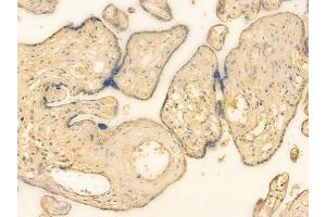 ABIN6262161 and ABIN6266557 at 1/100 staining human normal placenta tissue by IHC-P. (HCG beta Antikörper)