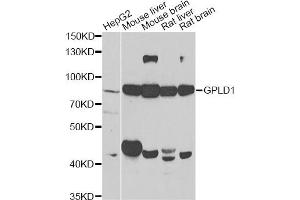 Western blot analysis of extracts of various cell lines, using GPLD1 antibody (ABIN2562895) at 1:1000 dilution. (GPLD1 Antikörper)