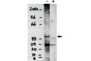 Image no. 1 for anti-Sphingosine-1-Phosphate Receptor 4 (S1PR4) (C-Term) antibody (ABIN201606) (S1PR4 Antikörper  (C-Term))