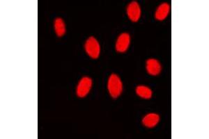 Immunofluorescent analysis of MKK3/6 staining in Jurkat cells. (MKK3/6 (Center) Antikörper)