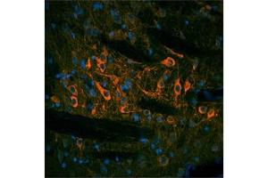 rat and mouse brain (TH Antikörper  (N-Term))