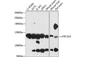 Western blot analysis of extracts of various cell lines, using  antibody (ABIN6127385, ABIN6137296, ABIN6137297 and ABIN6216941) at 1:3000 dilution. (ATP13A2 Antikörper  (AA 67-210))