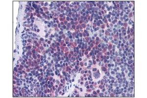 Image no. 1 for anti-T-Cell Immunoglobulin and Mucin Domain Containing 4 (TIMD4) (Center) antibody (ABIN302874) (TIMD4 Antikörper  (Center))