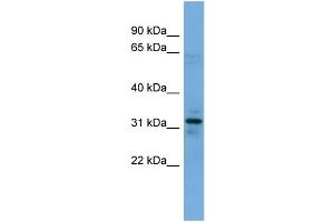 WB Suggested Anti-MYOZ1 Antibody Titration: 0.