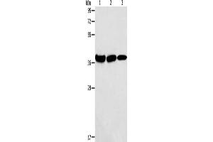 Gel: 10 % SDS-PAGE, Lysate: 40 μg, Lane 1-3: Mouse kidney tissue, human testis tissue, Human thyroid cancer tissue, Primary antibody: ABIN7128282(AGA Antibody) at dilution 1/100, Secondary antibody: Goat anti rabbit IgG at 1/8000 dilution, Exposure time: 10 seconds (AGA Antikörper)
