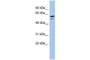WB Suggested Anti-ZNF248 Antibody Titration:  0. (ZNF248 Antikörper  (N-Term))