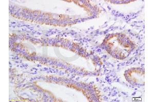Immunohistochemistry (IHC) image for anti-Solute Carrier Family 4, Sodium Bicarbonate Cotransporter, Member 7 (SLC4A7) (AA 1-100) antibody (ABIN687847)