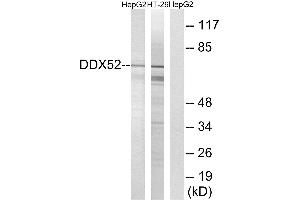 Western blot analysis of extracts from HepG2 cells and HT-29 cells, using DDX52 antibody. (DDX52 Antikörper  (C-Term))