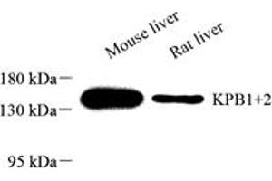 Western blot analysis of KPB1+2 (ABIN7074443) at dilution of 1: 2000,Lane 1: Mouse liver tissue lysate,Lane 2: Rat liver tissue lysate (KPB1/2 Antikörper)