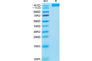 Human VEGF R2 on Tris-Bis PAGE under reduced condition. (VEGFR2/CD309 Protein (mFc Tag))