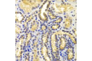 Immunohistochemistry of paraffin-embedded human kidney using EIF5A antibody (ABIN5971052) at dilution of 1/100 (40x lens).