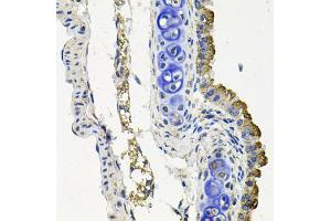 Immunohistochemistry of paraffin-embedded mouse lung using MARK1 antibody (ABIN5974592) at dilution of 1/100 (40x lens). (MARK1 Antikörper)