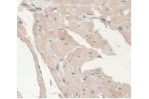 DAB staining on IHC-P Samples:Rat Heart Tissue (Androgen Receptor Antikörper  (AA 491-679))