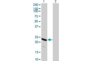 Western Blot analysis of HSPB8 expression in transfected 293T cell line by HSPB8 monoclonal antibody (M04), clone 5B12. (HSPB8 Antikörper  (AA 97-196))