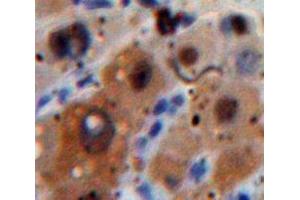 IHC-P analysis of Liver tissue, with DAB staining. (CSF3R Antikörper  (AA 271-428))