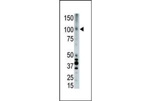 Western Blotting (WB) image for anti-Low Density Lipoprotein Receptor-Related Protein 8, Apolipoprotein E Receptor (LRP8) (AA 934-963), (C-Term) antibody (ABIN390101)