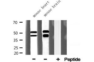 Western blot analysis of GSK3B expression in various lysates (GSK3 beta Antikörper  (N-Term))