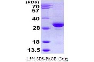SDS-PAGE (SDS) image for RAB32, Member RAS Oncogene Family (RAB32) (AA 1-225) protein (His tag) (ABIN667585)