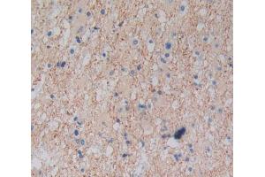 Used in DAB staining on fromalin fixed paraffin- embedded glioma tissue (Plexin A1 Antikörper  (AA 43-300))