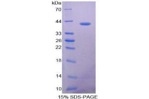 SDS-PAGE analysis of Human VCC1 Protein.