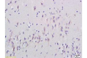 Immunohistochemistry (Paraffin-embedded Sections) (IHC (p)) image for anti-Synaptosomal-Associated Protein, 25kDa (SNAP25) (AA 166-206) antibody (ABIN738111)