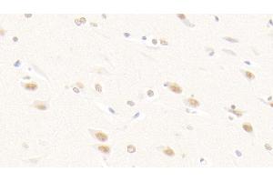 Detection of FGF2 in Human Cerebrum Tissue using Polyclonal Antibody to Fibroblast Growth Factor 2, Basic (FGF2) (FGF2 Antikörper  (AA 159-288))