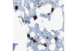Immunohistochemical staining of human bone marrow with SLC22A15 polyclonal antibody  shows strong cytoplasmic positivity in megakaryocytes. (SLC22A15 Antikörper)