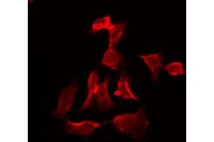 ABIN6273837 staining HT29 by IF/ICC. (Serotonin Receptor 3A Antikörper  (Internal Region))