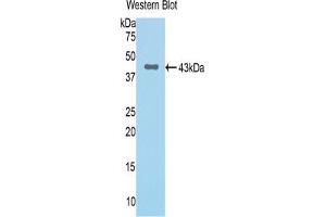 Western blot analysis of the recombinant protein. (Complement Factor B Antikörper  (AA 34-159))