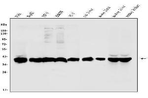 Western blot analysis of ALDOB using anti-ALDOB antibody (ABIN7602563).